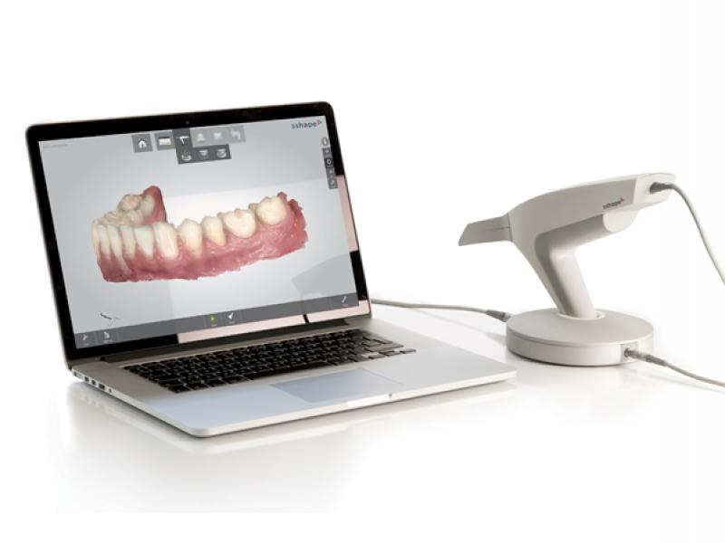 digital intraoral scanner